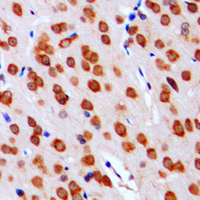 DGKA Antibody - Immunohistochemical analysis of DGK alpha staining in human brain formalin fixed paraffin embedded tissue section. The section was pre-treated using heat mediated antigen retrieval with sodium citrate buffer (pH 6.0). The section was then incubated with the antibody at room temperature and detected using an HRP conjugated compact polymer system. DAB was used as the chromogen. The section was then counterstained with hematoxylin and mounted with DPX.