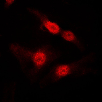 DGKA Antibody - Immunofluorescent analysis of DGK alpha staining in MDCK cells. Formalin-fixed cells were permeabilized with 0.1% Triton X-100 in TBS for 5-10 minutes and blocked with 3% BSA-PBS for 30 minutes at room temperature. Cells were probed with the primary antibody in 3% BSA-PBS and incubated overnight at 4 C in a humidified chamber. Cells were washed with PBST and incubated with a DyLight 594-conjugated secondary antibody (red) in PBS at room temperature in the dark. DAPI was used to stain the cell nuclei (blue).