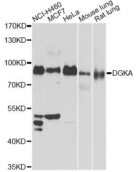 DGKA Antibody - Western blot analysis of extracts of various cell lines, using DGKA antibody at 1:1000 dilution. The secondary antibody used was an HRP Goat Anti-Rabbit IgG (H+L) at 1:10000 dilution. Lysates were loaded 25ug per lane and 3% nonfat dry milk in TBST was used for blocking. An ECL Kit was used for detection and the exposure time was 30s.