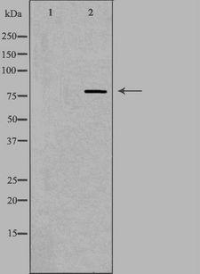 DGKA Antibody - Western blot analysis of extracts of Jurkat cells using DGKA antibody. The lane on the left is treated with the antigen-specific peptide.