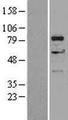 DGKA Protein - Western validation with an anti-DDK antibody * L: Control HEK293 lysate R: Over-expression lysate