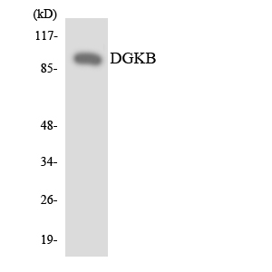 DGKB / DGK Beta Antibody - Western blot analysis of the lysates from HUVECcells using DGKB antibody.