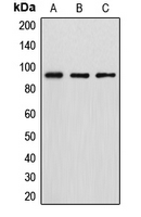 DGKB / DGK Beta Antibody - Western blot analysis of DGK beta expression in HT29 (A); MCF7 (B); HeLa (C) whole cell lysates.