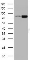 DGKB / DGK Beta Antibody - HEK293T cells were transfected with the pCMV6-ENTRY control (Left lane) or pCMV6-ENTRY DGKB (Right lane) cDNA for 48 hrs and lysed. Equivalent amounts of cell lysates (5 ug per lane) were separated by SDS-PAGE and immunoblotted with anti-DGKB.