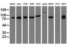 DGKB / DGK Beta Antibody - Western blot analysis of extracts (35ug) from 9 different cell lines by using anti-DGKB monoclonal antibody.