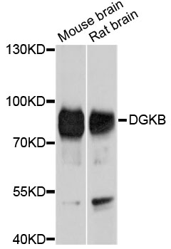 DGKB / DGK Beta Antibody - Western blot analysis of extracts of various cell lines, using DGKB antibody at 1:1000 dilution. The secondary antibody used was an HRP Goat Anti-Rabbit IgG (H+L) at 1:10000 dilution. Lysates were loaded 25ug per lane and 3% nonfat dry milk in TBST was used for blocking. An ECL Kit was used for detection and the exposure time was 10s.