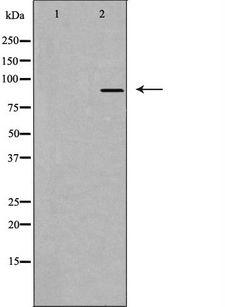 DGKB / DGK Beta Antibody - Western blot analysis of extracts of HuvEc cells using DGKB antibody. The lane on the left is treated with the antigen-specific peptide.