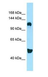 DGKD Antibody - DGKD antibody Western Blot of RPMI-8226.  This image was taken for the unconjugated form of this product. Other forms have not been tested.