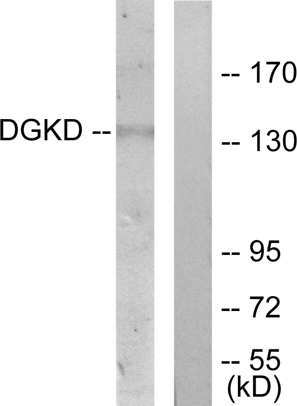 DGKD Antibody - Western blot analysis of lysates from HUVEC cells, using DGKD Antibody. The lane on the right is blocked with the synthesized peptide.