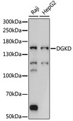 DGKD Antibody - Western blot analysis of extracts of various cell lines, using DGKD antibody at 1:1000 dilution. The secondary antibody used was an HRP Goat Anti-Rabbit IgG (H+L) at 1:10000 dilution. Lysates were loaded 25ug per lane and 3% nonfat dry milk in TBST was used for blocking. An ECL Kit was used for detection and the exposure time was 5s.