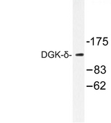 DGKD Antibody - Western blot of DGK- (S66) pAb in extracts from HUVEC cells.