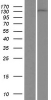 DGKD Protein - Western validation with an anti-DDK antibody * L: Control HEK293 lysate R: Over-expression lysate