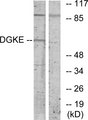 DGKE / DGK Epsilon Antibody - Western blot analysis of lysates from K562 cells, using DGKE Antibody. The lane on the right is blocked with the synthesized peptide.