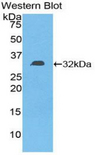 DGKE / DGK Epsilon Antibody - Western blot of recombinant DGKE / DGK.  This image was taken for the unconjugated form of this product. Other forms have not been tested.