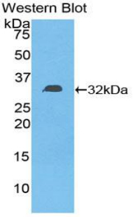 DGKE / DGK Epsilon Antibody - Western blot of recombinant DGKE / DGK.  This image was taken for the unconjugated form of this product. Other forms have not been tested.