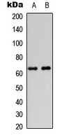 DGKE / DGK Epsilon Antibody - Western blot analysis of DGK epsilon expression in HeLa (A); HEK293T (B) whole cell lysates.