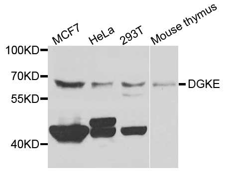 DGKE / DGK Epsilon Antibody - Western blot analysis of extracts of various cells.