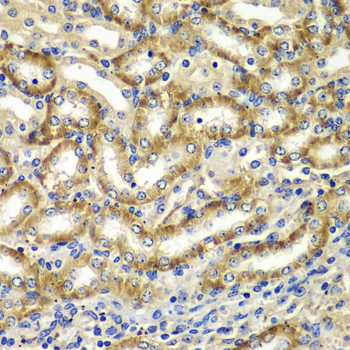 DGKE / DGK Epsilon Antibody - Immunohistochemistry of paraffin-embedded mouse kidney tissue.