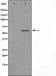 DGKE / DGK Epsilon Antibody - Western blot analysis of extracts of K562 cells using DGKE antibody. The lane on the left is treated with the antigen-specific peptide.