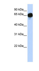 DGKE / DGK Epsilon Antibody - DGKE antibody Western blot of Fetal Brain lysate. This image was taken for the unconjugated form of this product. Other forms have not been tested.