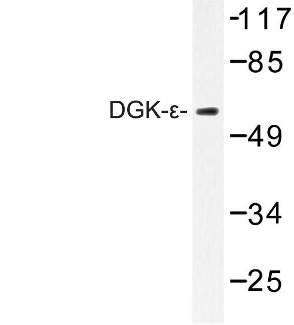 DGKE / DGK Epsilon Antibody - Western blot of DGK- (S194) pAb in extracts from K562 cells.