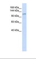 DGKeta / DGKH Antibody - Fetal heart lysate. Antibody concentration: 1.0 ug/ml. Gel concentration: 6-18%.  This image was taken for the unconjugated form of this product. Other forms have not been tested.