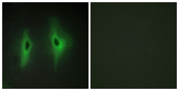 DGKeta / DGKH Antibody - Immunofluorescence analysis of HeLa cells, using DGKH Antibody. The picture on the right is blocked with the synthesized peptide.