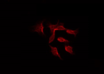 DGKeta / DGKH Antibody - Staining HeLa cells by IF/ICC. The samples were fixed with PFA and permeabilized in 0.1% Triton X-100, then blocked in 10% serum for 45 min at 25°C. The primary antibody was diluted at 1:200 and incubated with the sample for 1 hour at 37°C. An Alexa Fluor 594 conjugated goat anti-rabbit IgG (H+L) Ab, diluted at 1/600, was used as the secondary antibody.