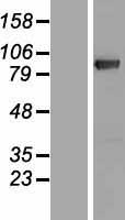 DGKG Protein - Western validation with an anti-DDK antibody * L: Control HEK293 lysate R: Over-expression lysate