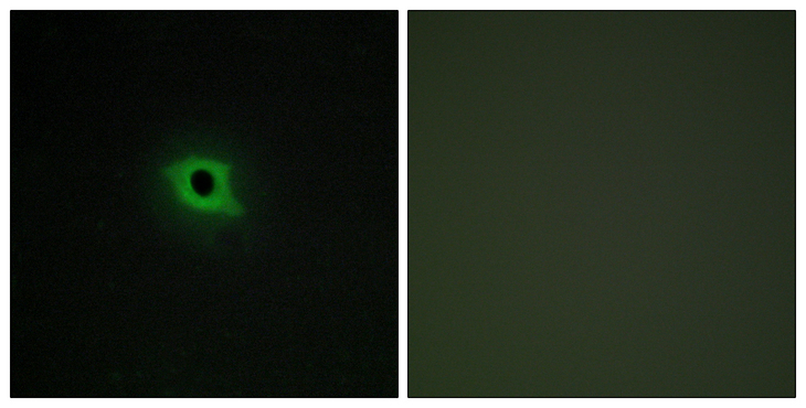 DGKK Antibody - Immunofluorescence analysis of COS7 cells, using DGKK Antibody. The picture on the right is blocked with the synthesized peptide.