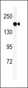 DGKK Antibody - Western blot of DGKK Antibody in mouse lung tissue lysates (35 ug/lane). DGKK (arrow) was detected using the purified antibody.