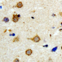 DGKK Antibody - Immunohistochemical analysis of DGK kappa staining in human brain formalin fixed paraffin embedded tissue section. The section was pre-treated using heat mediated antigen retrieval with sodium citrate buffer (pH 6.0). The section was then incubated with the antibody at room temperature and detected using an HRP conjugated compact polymer system. DAB was used as the chromogen. The section was then counterstained with hematoxylin and mounted with DPX.