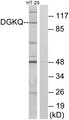 DGKQ Antibody - Western blot analysis of lysates from HT-29 cells, using DGKQ Antibody. The lane on the right is blocked with the synthesized peptide.