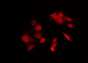 DGKQ Antibody - Staining HT29 cells by IF/ICC. The samples were fixed with PFA and permeabilized in 0.1% Triton X-100, then blocked in 10% serum for 45 min at 25°C. The primary antibody was diluted at 1:200 and incubated with the sample for 1 hour at 37°C. An Alexa Fluor 594 conjugated goat anti-rabbit IgG (H+L) Ab, diluted at 1/600, was used as the secondary antibody.
