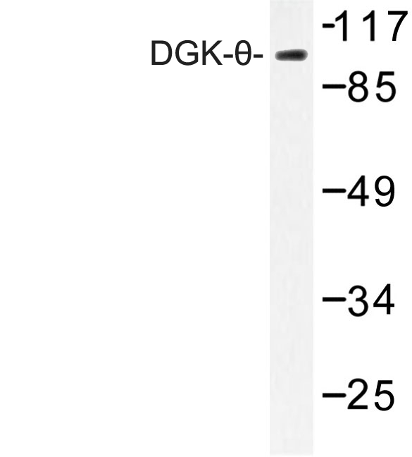 DGKQ Antibody - Western blot of DGK- (S725) pAb in extracts from HT-29 cells.