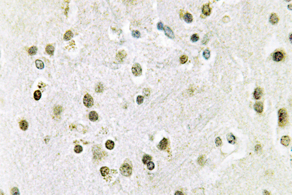DGKQ Antibody - IHC of DGK- (S725) pAb in paraffin-embedded human brain tissue.
