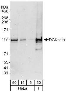DGKZ Antibody - Detection of Human DGK zeta by Western Blot. Samples: Whole cell lysate from HeLa (5, 15 and 50 ug for WB) and 293T (T; 50 ug) cells. Antibodies: Affinity purified rabbit anti-DGK zeta antibody used for WB at 0.1 ug/ml. Detection: Chemiluminescence with an exposure time of 30 seconds.