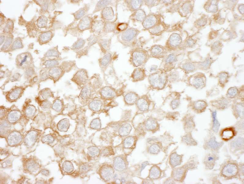 Anti-DGKZ Antibody | Rabbit Anti-Human Polyclonal IHC,WB | LSBio