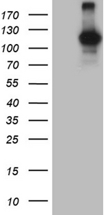 DGKZ Antibody - HEK293T cells were transfected with the pCMV6-ENTRY control. (Left lane) or pCMV6-ENTRY DGKZ. (Right lane) cDNA for 48 hrs and lysed. Equivalent amounts of cell lysates. (5 ug per lane) were separated by SDS-PAGE and immunoblotted with anti-DGKZ. (1:2000)