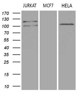 DGKZ Antibody - Western blot analysis of extracts. (35ug) from 3 different cell lines by using anti-DGKZ monoclonal antibody. (1:500)