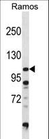 DGKZ Antibody - DGKZ Antibody (D1004) western blot of Ramos cell line lysates (35 ug/lane). The DGKZ antibody detected the DGKZ protein (arrow).