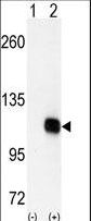 DGKZ Antibody - Western blot of DGKZ (arrow) using DGKZ Antibody. 293 cell lysates (2 ug/lane) either nontransfected (Lane 1) or transiently transfected with the DGKZ gene (Lane 2) (Origene Technologies).