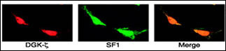 DGKZ Antibody - SF1 colocalizes with DGK and PA in the nuclei of H295R cells. Cells were plated onto glass coverslips, fixed, permeabilized, and incubated with anti-SF1 and anti-DGKZ (B) for 1 h. Cover slips were washed and incubated with anti-fluorescein isothiocyanate and anti-rhodamine, and immunofluorescence was detected by confocal microscopy.