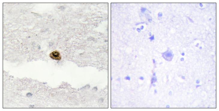 DGKZ Antibody - Peptide - + Immunohistochemistry analysis of paraffin-embedded human brain tissue, using DGKZ antibody.
