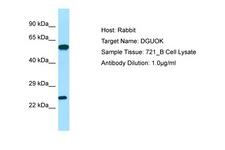 DGUOK / Deoxyguanosine Kinase Antibody -  This image was taken for the unconjugated form of this product. Other forms have not been tested.