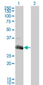 DGUOK / Deoxyguanosine Kinase Antibody - Western Blot analysis of DGUOK expression in transfected 293T cell line by DGUOK monoclonal antibody (M02), clone 3E9.Lane 1: DGUOK transfected lysate(32.056 KDa).Lane 2: Non-transfected lysate.