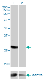 DGUOK / Deoxyguanosine Kinase Antibody - Western blot analysis of DGUOK over-expressed 293 cell line, cotransfected with DGUOK Validated Chimera RNAi (Lane 2) or non-transfected control (Lane 1). Blot probed with DGUOK monoclonal antibody (M02), clone 3E9 . GAPDH ( 36.1 kDa ) used as specificity and loading control.