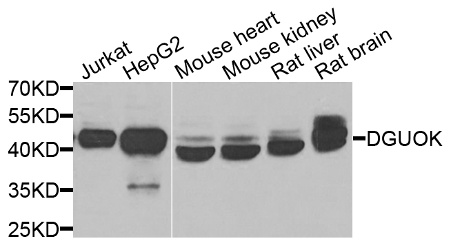 DGUOK / Deoxyguanosine Kinase Antibody - Western blot analysis of extracts of various cell lines.