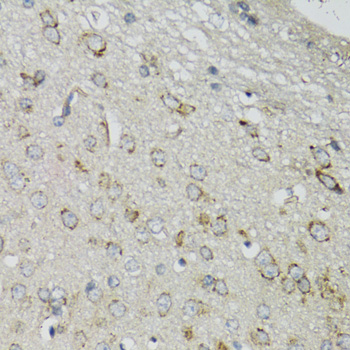 DGUOK / Deoxyguanosine Kinase Antibody - Immunohistochemistry of paraffin-embedded mouse brain tissue.