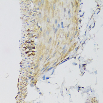 DGUOK / Deoxyguanosine Kinase Antibody - Immunohistochemistry of paraffin-embedded mouse stomach tissue.
